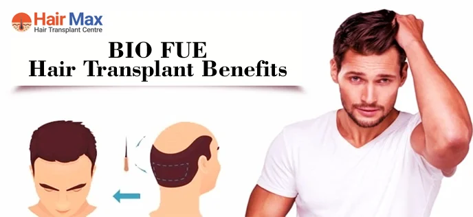 BIO FUE Hair Transplant Benefits, And Strategy That The Specialist Uses